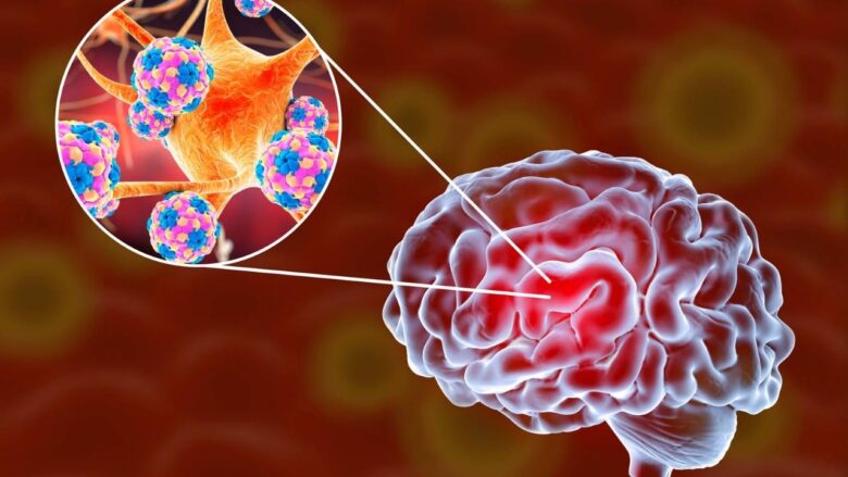 A Crise da Meningite em Alagoas